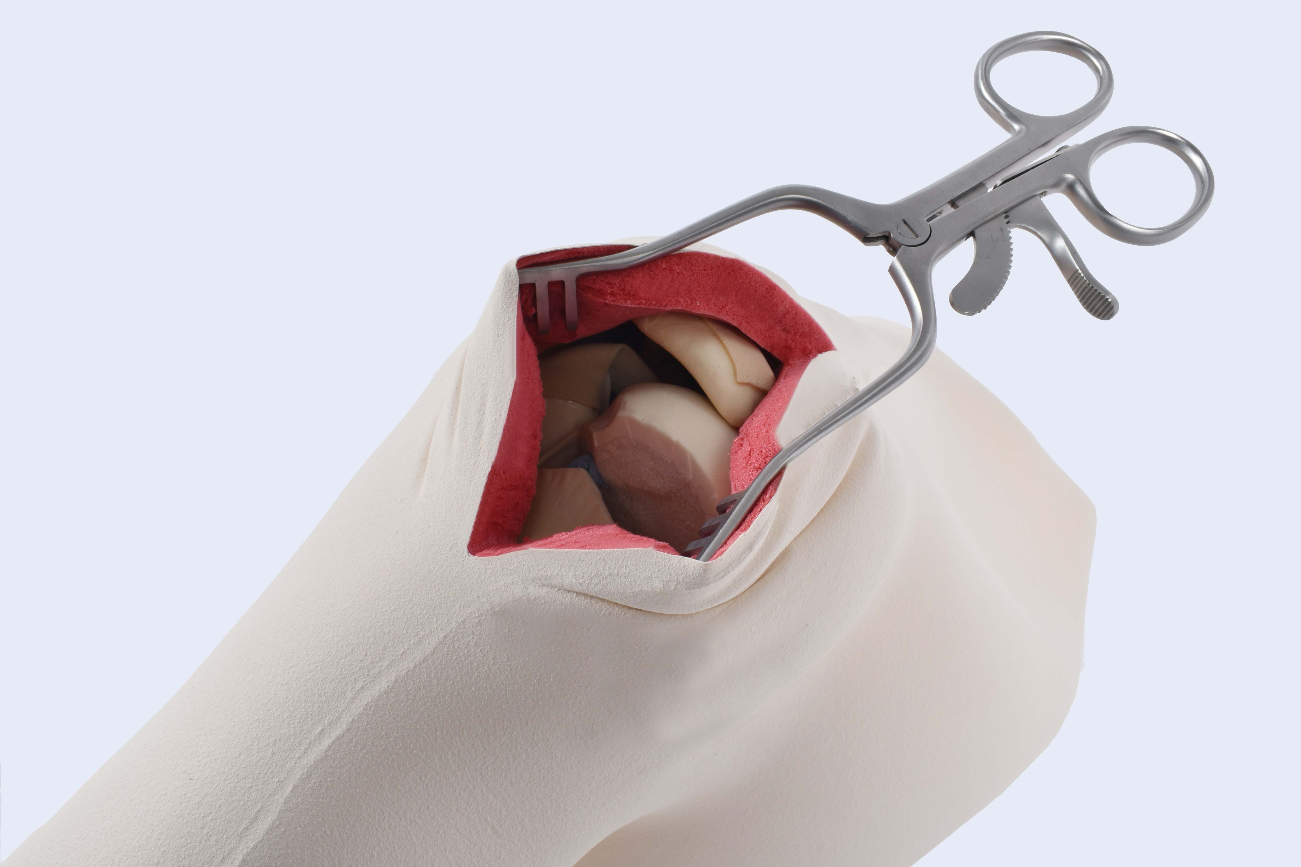 Shoulder left w/ fractured humerus, vice attachment a/ soft tissue