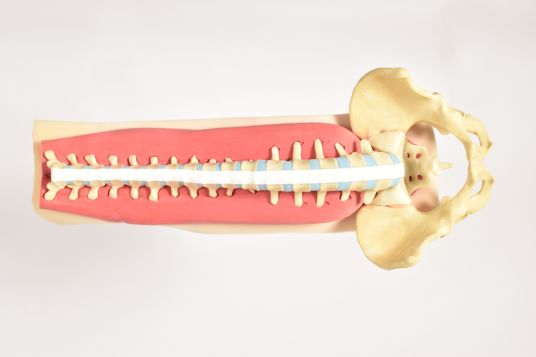 Soft Tissues of the Lumbar Spine